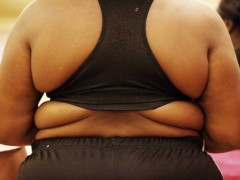 Obesidad reduce la esperanza de vida Obesidad reduce la esperanza de vida