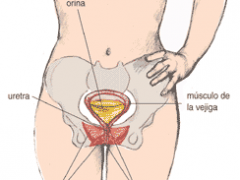 Incontinencia urinaria: nuevo tratamiento Incontinencia urinaria: nuevo tratamiento