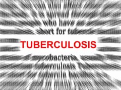 Tuberculosis: erradicarla para el 2050 Tuberculosis: erradicarla para el 2050