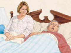 Ronquido por apnea del sueño Ronquido por apnea del sueño