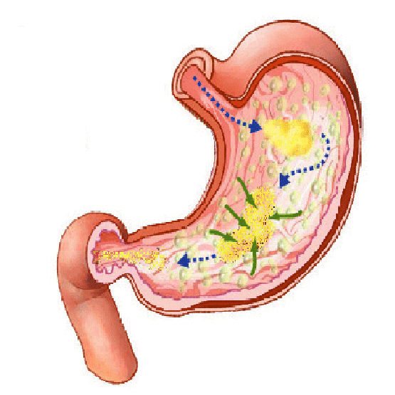 Científicos graban proceso digestivo dentro del estómago - Cuida tu salud  con Diane Pérez